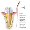Gutta Percha Points Natudeco 200pcs Temperature‑Sensitive Dental Fill-5